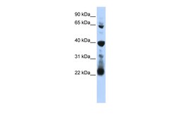 Aviva Systems Biology Corp RPUSD3 Antibody - middle region (ARP41173_P050)
