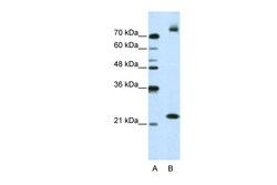 Aviva Systems Biology Corp FZD9 Antibody - N-terminal region (ARP41253_T100)