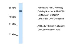 Aviva Systems Biology Corp FTCD Antibody - N-terminal region (ARP41576_T100)