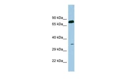 Aviva Systems Biology Corp SDS Antibody - N-terminal region (ARP41582_P050)