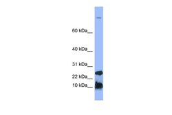 Aviva Systems Biology Corp HAMP Antibody - N-terminal region (ARP41620_P050)