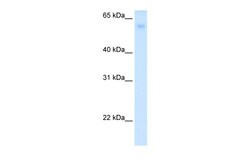 Aviva Systems Biology Corp SLC2A2 Antibody - N-terminal region (ARP41706_P050)