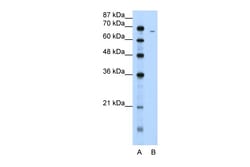 Aviva Systems Biology Corp FGA Antibody - N-terminal region (ARP41758_T100)