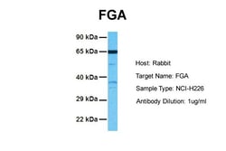 Aviva Systems Biology Corp FGA Antibody - middle region (ARP41759_P050)