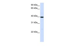 Aviva Systems Biology Corp ADH1A Antibody - N-terminal region (ARP41785_P050)