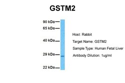 Aviva Systems Biology Corp GSTM2 Antibody - N-terminal region (ARP41818_P050)