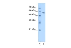 Aviva Systems Biology Corp CES1 Antibody - N-terminal region (ARP41877_T100)