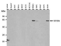 Aviva Systems Biology Corp CES1 Antibody - C-terminal region (ARP41878_T100)