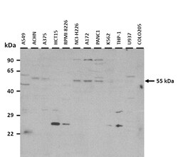 Aviva Systems Biology Corp IFIT2 Antibody - N-terminal region (ARP41950_P050)