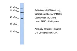 Aviva Systems Biology Corp IL8RB Antibody - N-terminal region (ARP41956_P050)