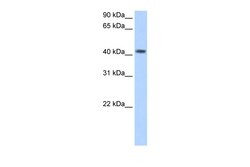 Aviva Systems Biology Corp PSG5 Antibody - N-terminal region (ARP42067_T100)