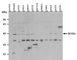 Aviva Systems Biology Corp PSG5 Antibody - middle region (ARP42068_P050)