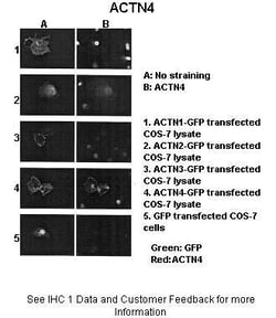 Aviva Systems Biology Corp ACTN4 Antibody - N-terminal region (ARP42202_T100)