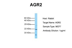 Aviva Systems Biology Corp AGR2 Antibody - middle region (ARP42290_P050)