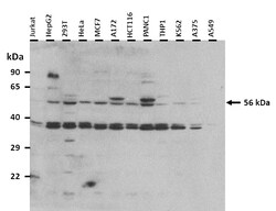 Aviva Systems Biology Corp SLC38A3 Antibody - N-terminal region (ARP42323_P050)
