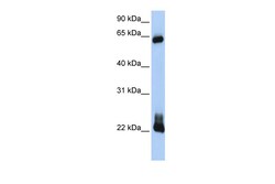 Aviva Systems Biology Corp RHOD Antibody - C-terminal region (ARP42414_P050)