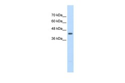 Aviva Systems Biology Corp UPB1 Antibody - middle region (ARP42467_T100)