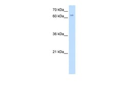 Aviva Systems Biology Corp RBM35A Antibody - N-terminal region (ARP42489_T100)