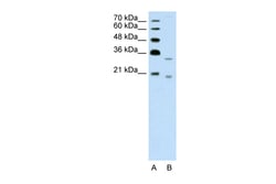 Aviva Systems Biology Corp DNASE2B Antibody - C-terminal region (ARP42595_T100)