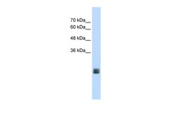 Aviva Systems Biology Corp MGC33926 Antibody - middle region (ARP42935_T100)
