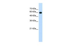 Aviva Systems Biology Corp CDC23 Antibody - N-terminal region (ARP43039_T100)