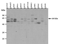 Aviva Systems Biology Corp ARIH1 Antibody - C-terminal region (ARP43054_T100)