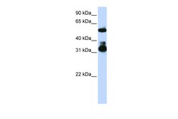 Aviva Systems Biology Corp FBXW2 Antibody - middle region (ARP43109_P050)