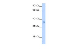 Aviva Systems Biology Corp NOV Antibody - C-terminal region (ARP43613_T100)