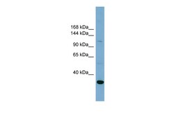 Aviva Systems Biology Corp SLC9A1 Antibody - middle region (ARP43840_P050)