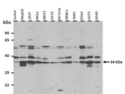 Aviva Systems Biology Corp SLC25A38 Antibody - middle region (ARP43978_P050)