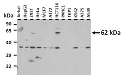 Aviva Systems Biology Corp SLC15A4 Antibody - middle region (ARP44109_P050)