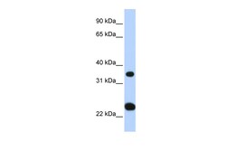 Aviva Systems Biology Corp SLC25A35 Antibody - N-terminal region (ARP44177_P050)
