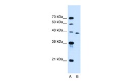Aviva Systems Biology Corp SLC16A12 Antibody - N-terminal region (ARP44186_P050)