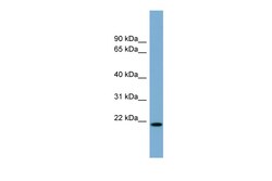 Aviva Systems Biology Corp CYBA Antibody - middle region (ARP44214_P050)