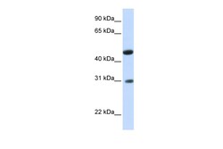 Aviva Systems Biology Corp GLTPD2 Antibody - N-terminal region (ARP44686_P050)
