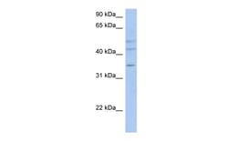Aviva Systems Biology Corp PXYLP1 Antibody - N-terminal region (ARP44835_P050)