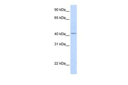 Aviva Systems Biology Corp COX10 Antibody - middle region (ARP45079_P050)