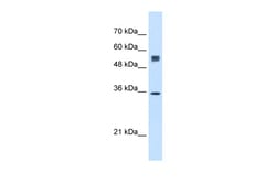 Aviva Systems Biology Corp SSR1 Antibody - N-terminal region (ARP45426_P050)