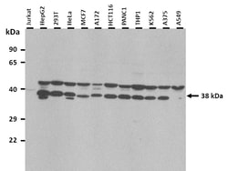 Aviva Systems Biology Corp DEGS1 Antibody - N-terminal region (ARP45501_P050)