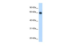 Aviva Systems Biology Corp KNG1 Antibody - middle region (ARP45680_P050)