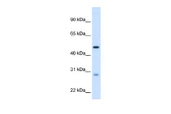 Aviva Systems Biology Corp ECHS1 Antibody - C-terminal region (ARP45700_T100)