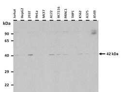 Aviva Systems Biology Corp SAMSN1 Antibody - middle region (ARP45875_P050)