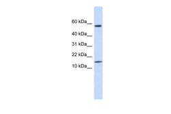Aviva Systems Biology Corp KRTAP11-1 Antibody - N-terminal region (ARP45923_P050)