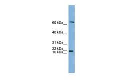 Aviva Systems Biology Corp GM2A Antibody - N-terminal region (ARP46008_P050)