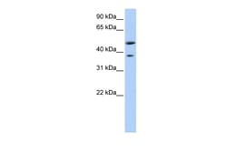 Aviva Systems Biology Corp MAGEA3 Antibody - middle region (ARP46123_P050)