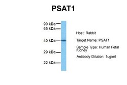 Aviva Systems Biology Corp PSAT1 Antibody - N-terminal region (ARP46303_P050)