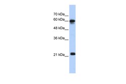 Aviva Systems Biology Corp SEMA4F Antibody - N-terminal region (ARP46421_P050)