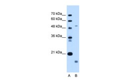 Aviva Systems Biology Corp ZMPSTE24 Antibody - N-terminal region (ARP46665_P050)
