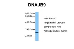 Aviva Systems Biology Corp DNAJB9 Antibody - N-terminal region (ARP46885_P050)