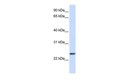 Aviva Systems Biology Corp ERVWE1 Antibody - N-terminal region (ARP47043_P050)